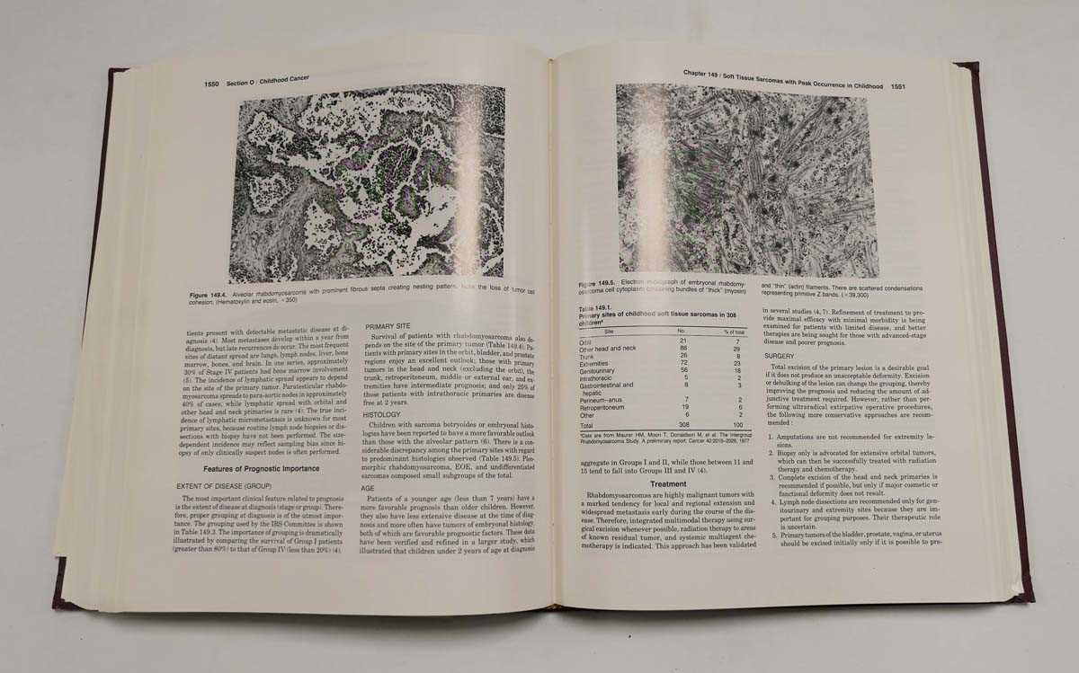 Moossa A., Schimpff S. & Robson M. ( Editors ) : Comprehensive Textbook of Oncology, 1991. 2nd. - Bild 7 aus 8