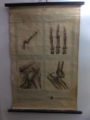 Collectable Genuine old wall hanging canvas chart of the Human bone dislocation