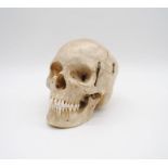 A human skull for medical purposes with detachable braincase and lower jaw with complete set of