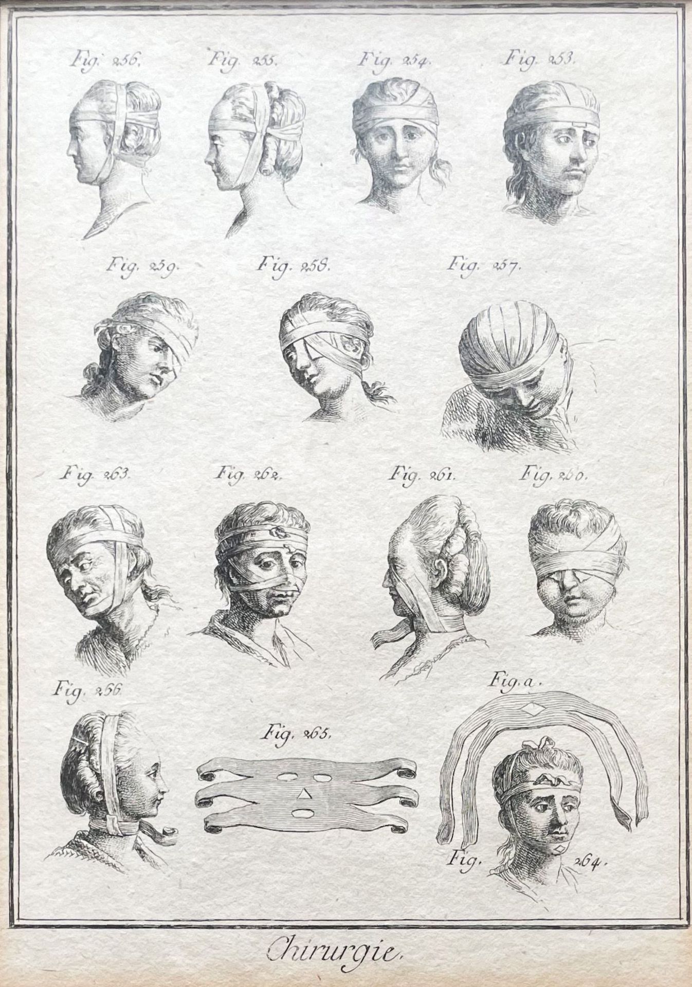 Gemischtes Konvolut: Lithographie "Chirurgie", 21 x 15,5 cm; ovales Tablett, versilbert, 39 x 23 cm; - Bild 2 aus 3