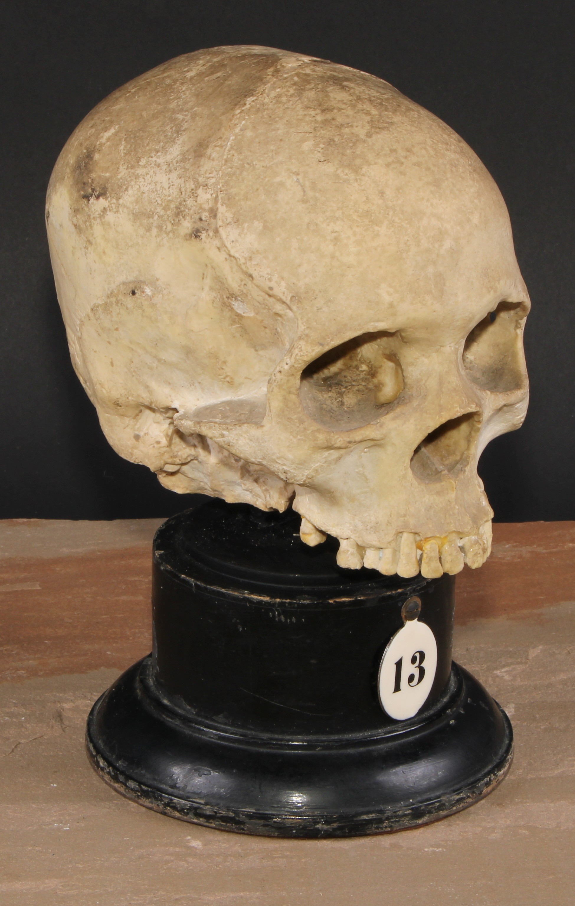 Medical - Anatomy - an early 20th century doctor's plaster anatomical model, of a human skull,