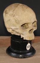 Medical - Anatomy - an early 20th century doctor's plaster anatomical model, of a human skull,