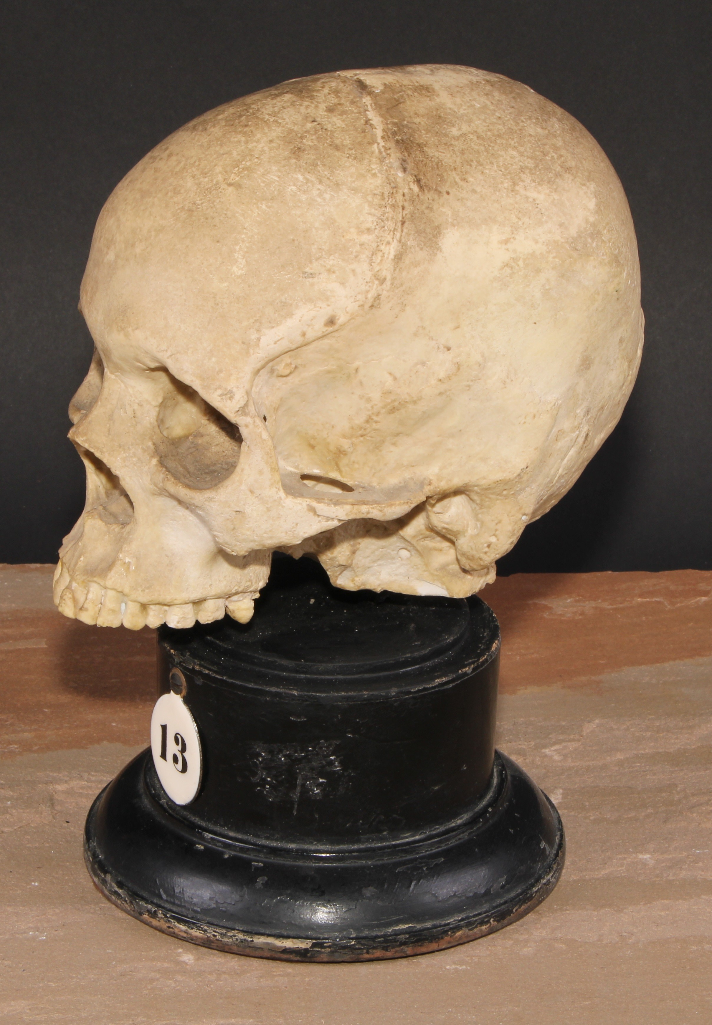 Medical - Anatomy - an early 20th century doctor's plaster anatomical model, of a human skull, - Image 2 of 3