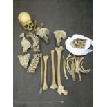 A partial medical human skeleton comprised of skull, vertebrae, part male and part female pelvis,