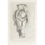 HUNTER (WILLIAM) Anatomia uteri humani gravidi tabulis illustrata. The Anatomy of the Human Grav...