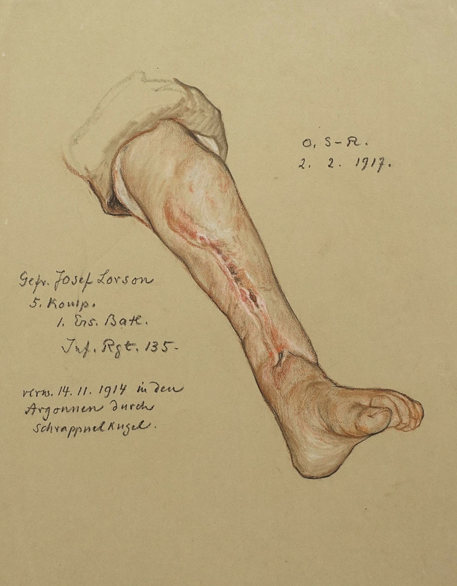Otto Sohn-Rethel (1877-1949), Study of a leg injury