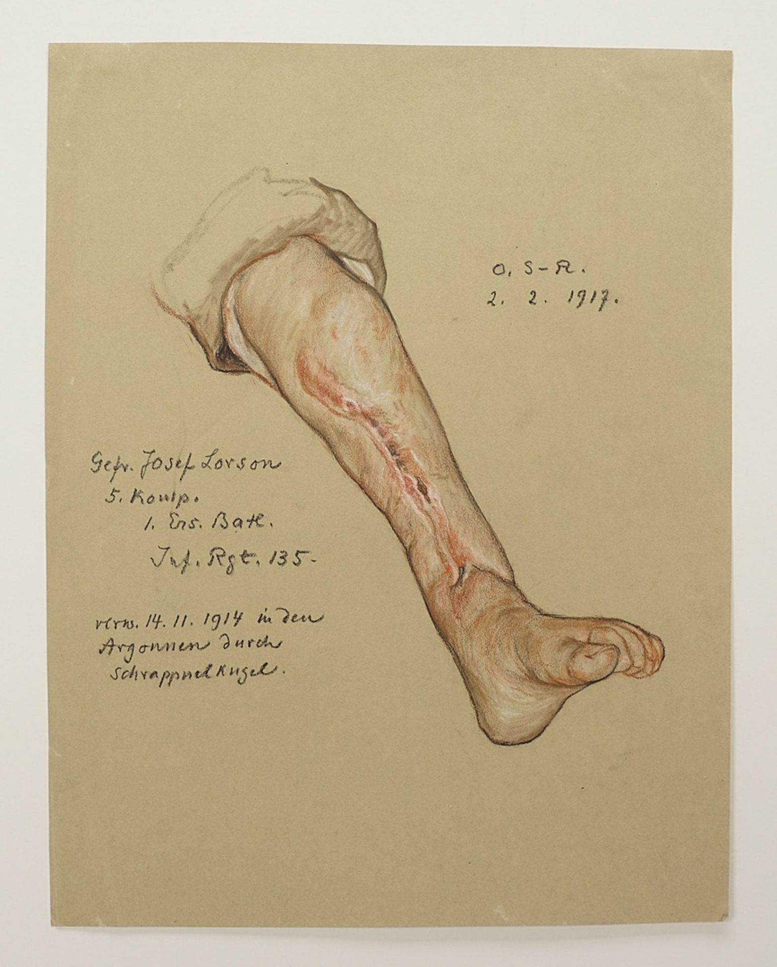 Otto Sohn-Rethel (1877-1949), Study of a leg injury - Image 3 of 3