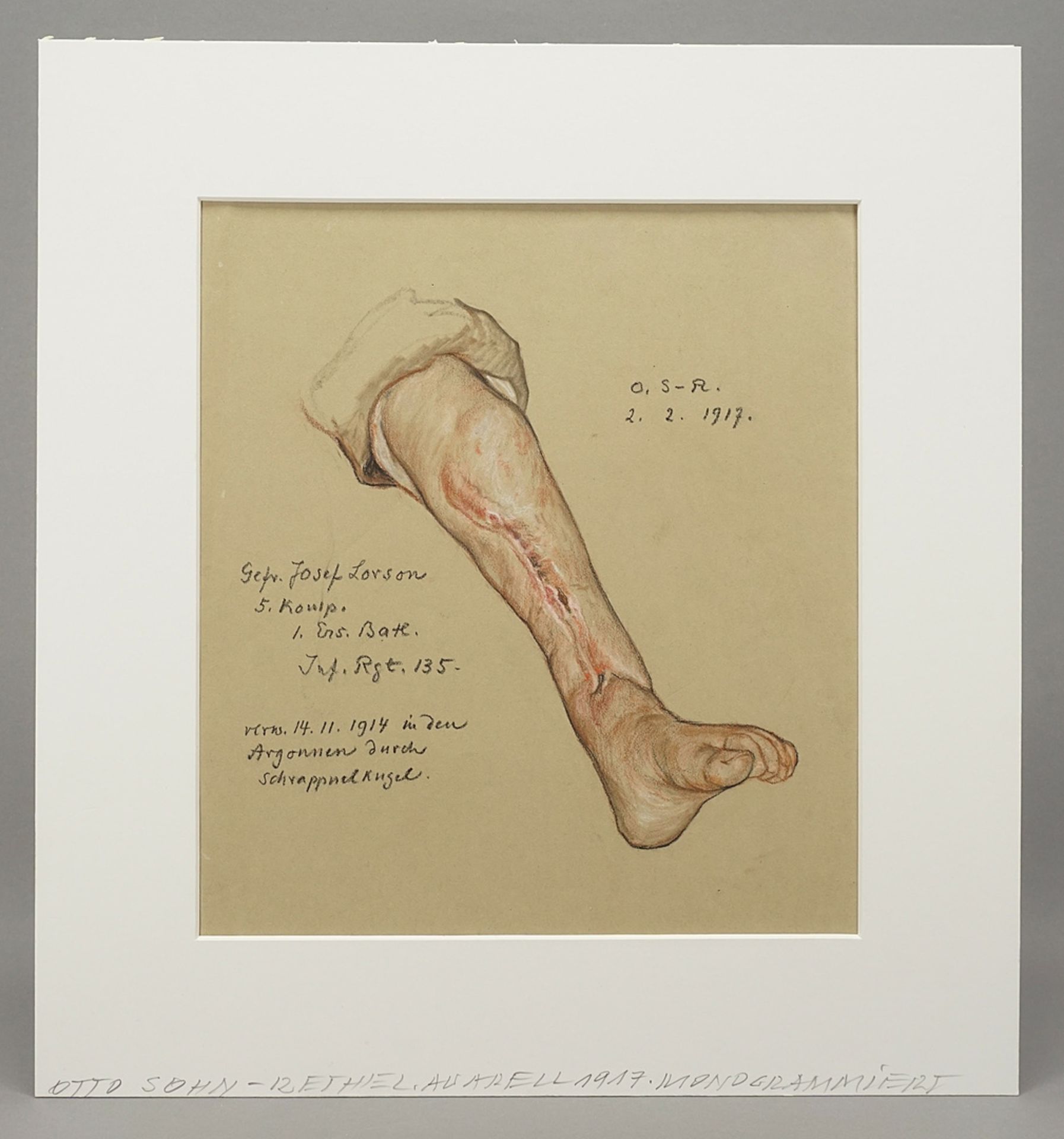 Otto Sohn-Rethel (1877-1949), Study of a leg injury - Image 2 of 3