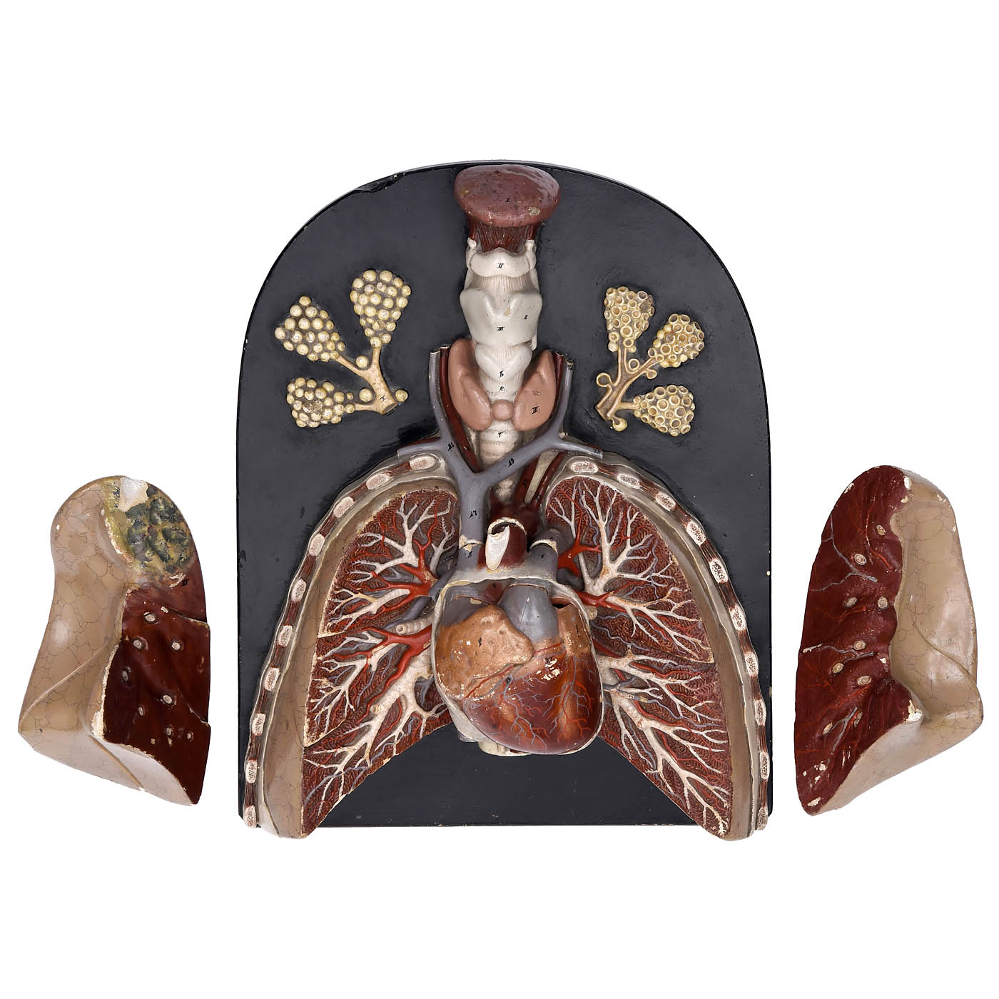 Anatomical Model of the Heart and Lungs, c. 1920 - Image 5 of 5