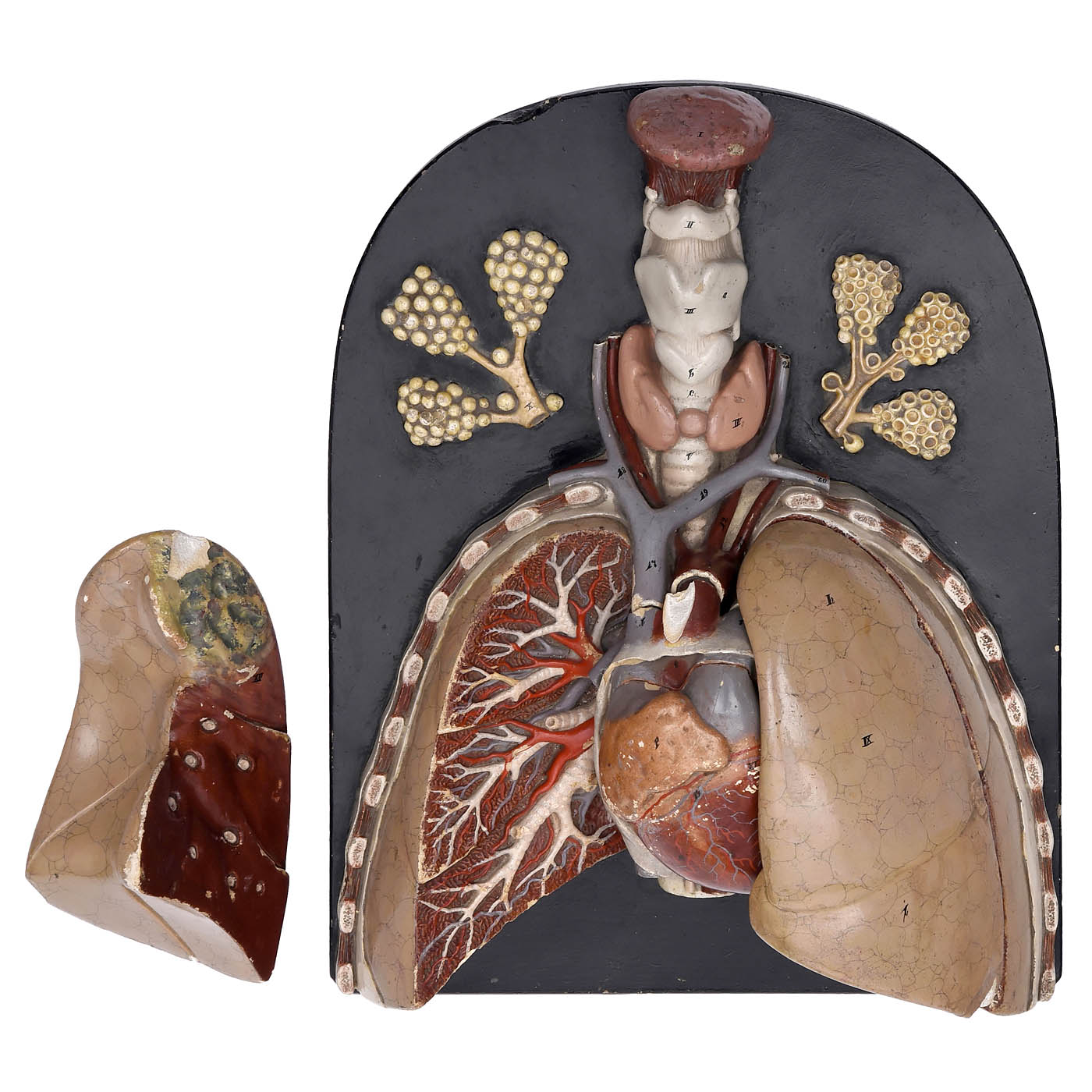 Anatomical Model of the Heart and Lungs, c. 1920 - Image 2 of 5