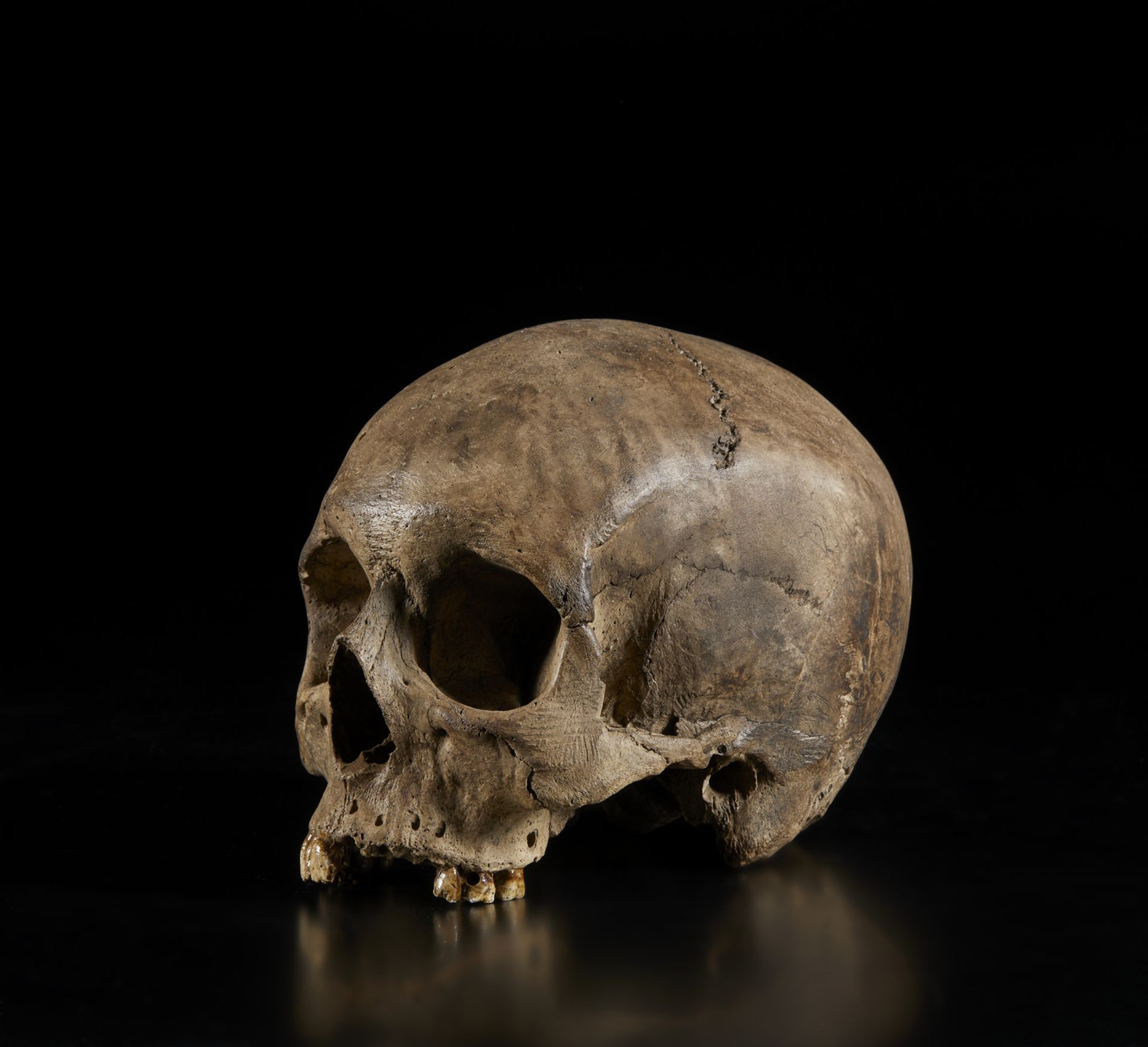 . A natural size plaster model of a human skullItaly, 19th(?) century. - Image 5 of 6
