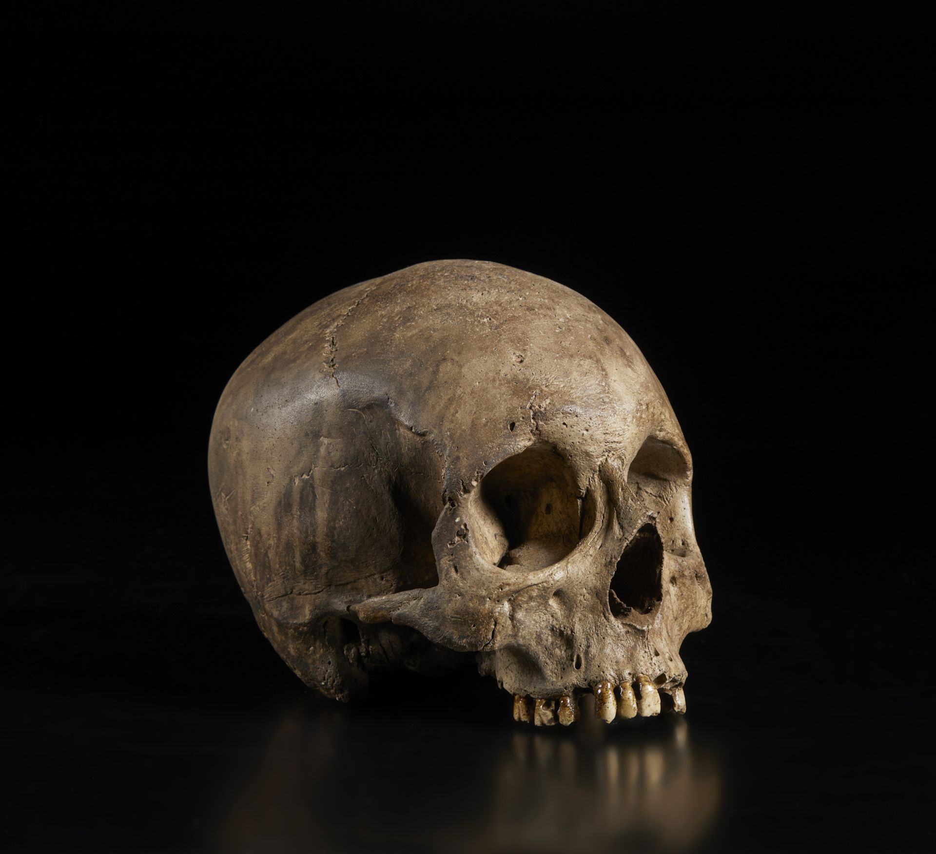 . A natural size plaster model of a human skullItaly, 19th(?) century.