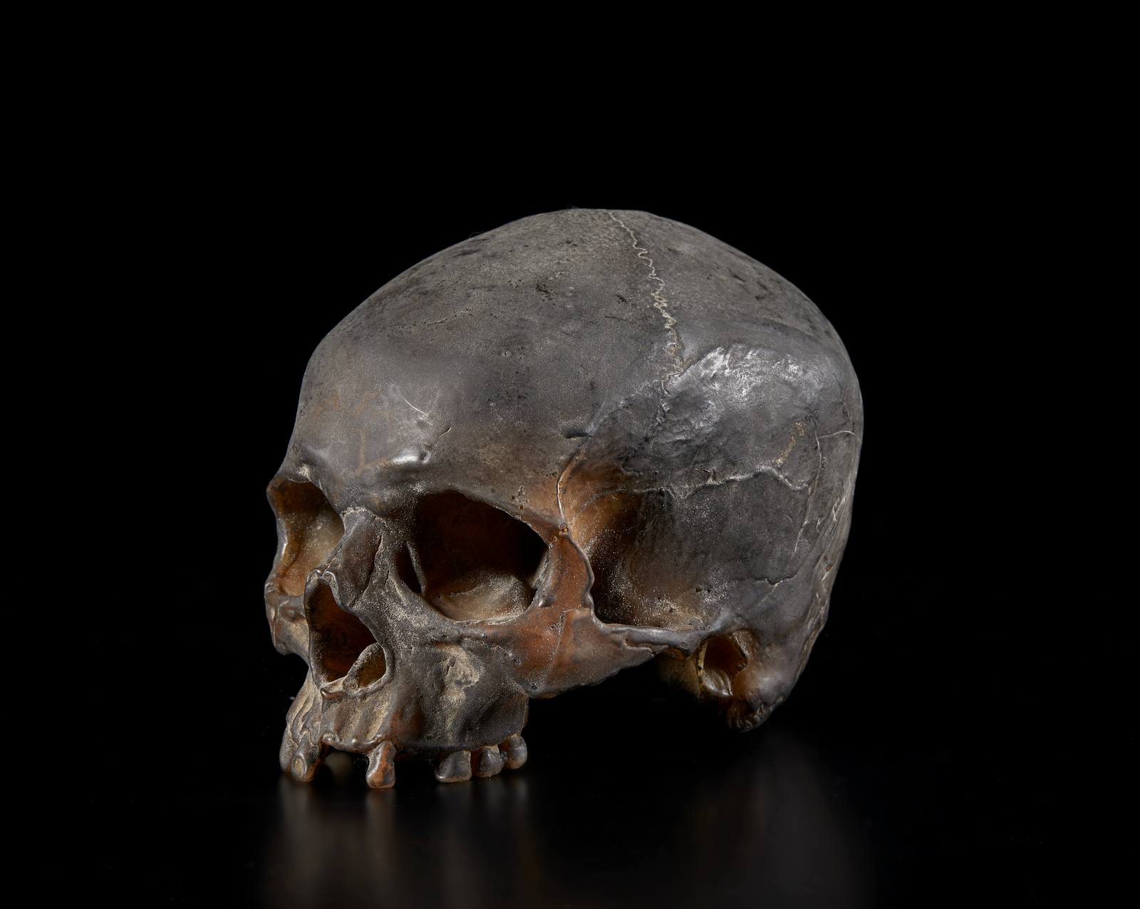 . A real size wax model of a human skullItaly, 19th(?) century. - Image 5 of 6