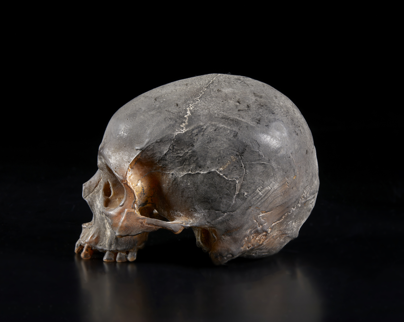 . A real size wax model of a human skullItaly, 19th(?) century. - Image 4 of 6