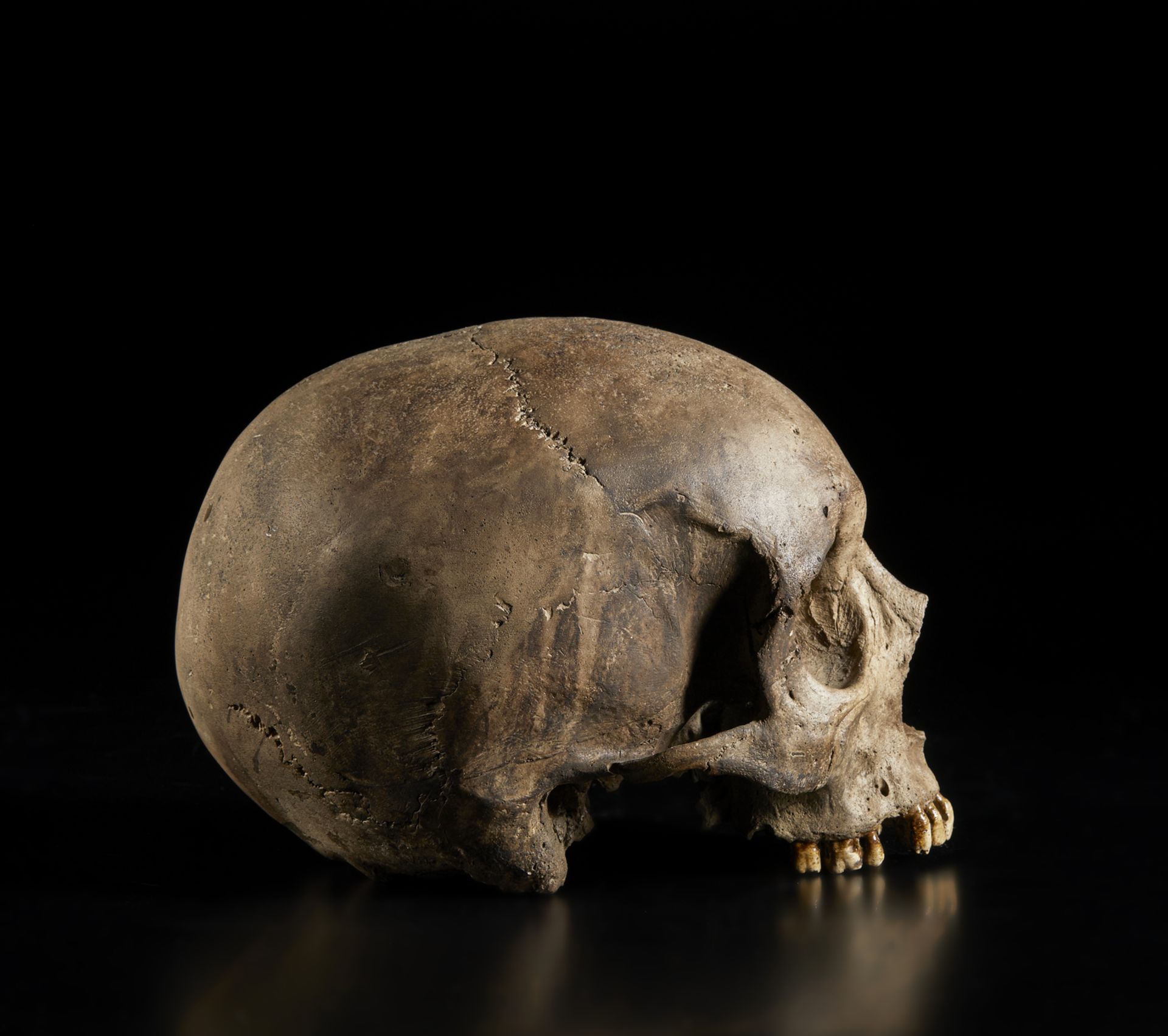 . A natural size plaster model of a human skullItaly, 19th(?) century. - Image 3 of 6