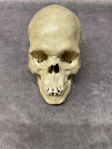 A very good antique human skull with wired mandible