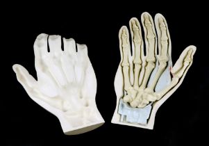 A 20th century anatomical medical plastic life size Hand teaching aid in three parts for medical