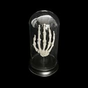 AN ANTIQUE GENUINE HUMAN SKELETAL HAND IN GLASS DOME