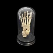AN ANTIQUE GENUINE HUMAN SKELETAL FOOT IN GLASS DOME