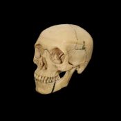 A VINTAGE RESIN ANATOMICAL MODEL OF A HUMAN SKULL WITH DENTAL BRACES