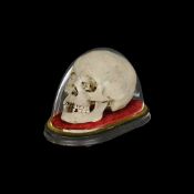 A MEDICALLY PREPARED ANTIQUE HUMAN SKULL UNDER A GLASS DOME