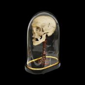 AN ANTIQUE MEDICALLY PREPARED HUMAN SKULL UNDER A GLASS DOME