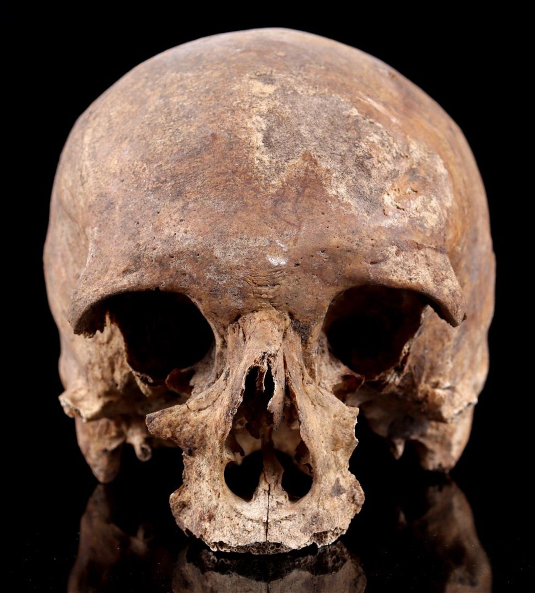Human skull - Bild 2 aus 6