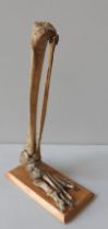 AN ANATOMICAL HUMAN TIBIA, FIBULA AND SKELETAL FOOT, LATE 19TH / EARLY 20TH CENTURY, mounted on a