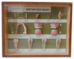 A SOMSO ANATOMICAL DISPLAY PANEL OF HUMAN TEETH, MID 20TH CENTURY, mounted in a display case 26 x 32