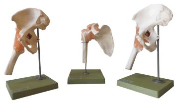 THREE VINTAGE SOMSO ANATOMICAL MODELS, MID 20TH CENTURY, two of the human hip joint and one of the