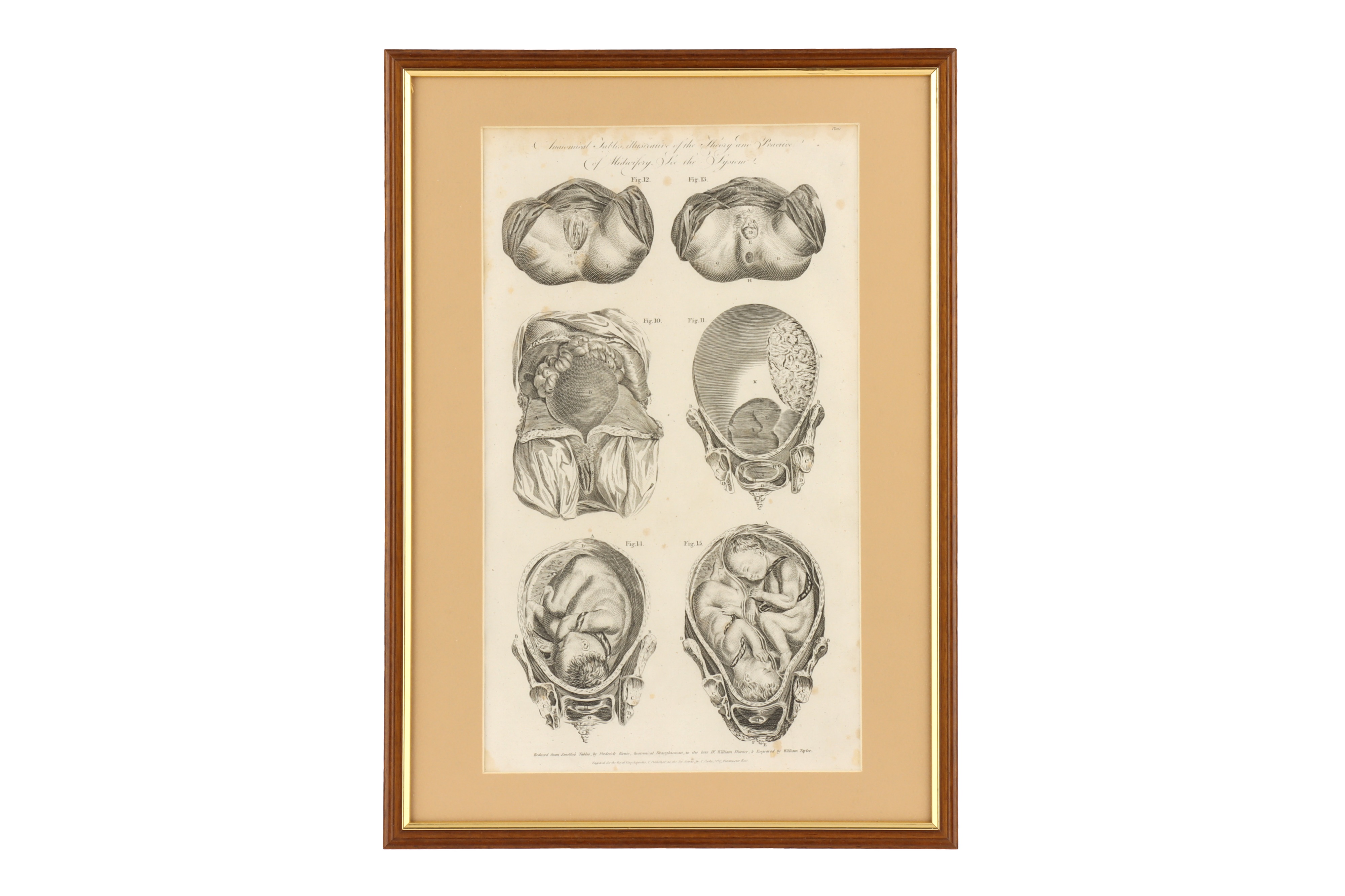 Eight Framed Antique Medical Prints, - Image 6 of 9