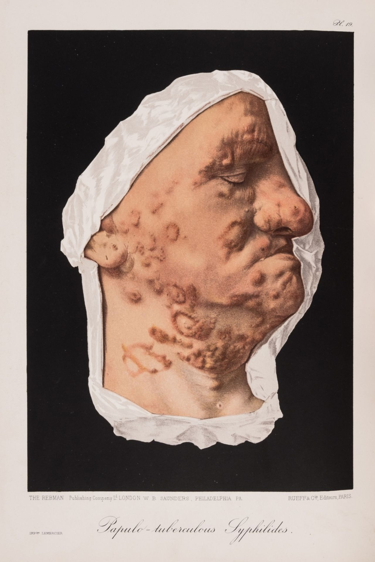 Dermatology.- Besnier (E.) and others, A Pictorial Atlas of Skin Diseases and Syphilitic …