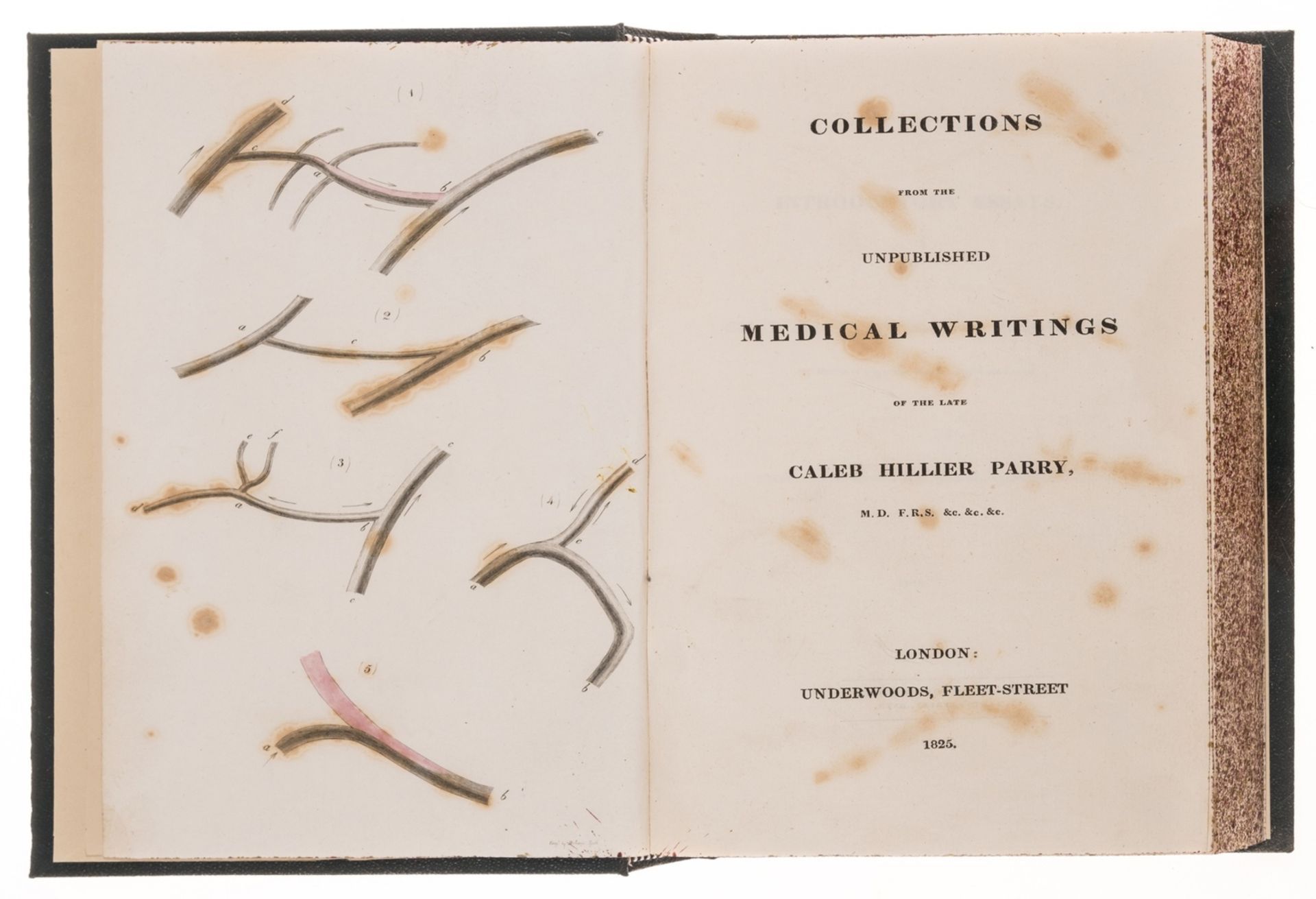 Parry (Caleb Hillier) Collections from the Unpublished Medical Writings..., 3 vol., only edition, …