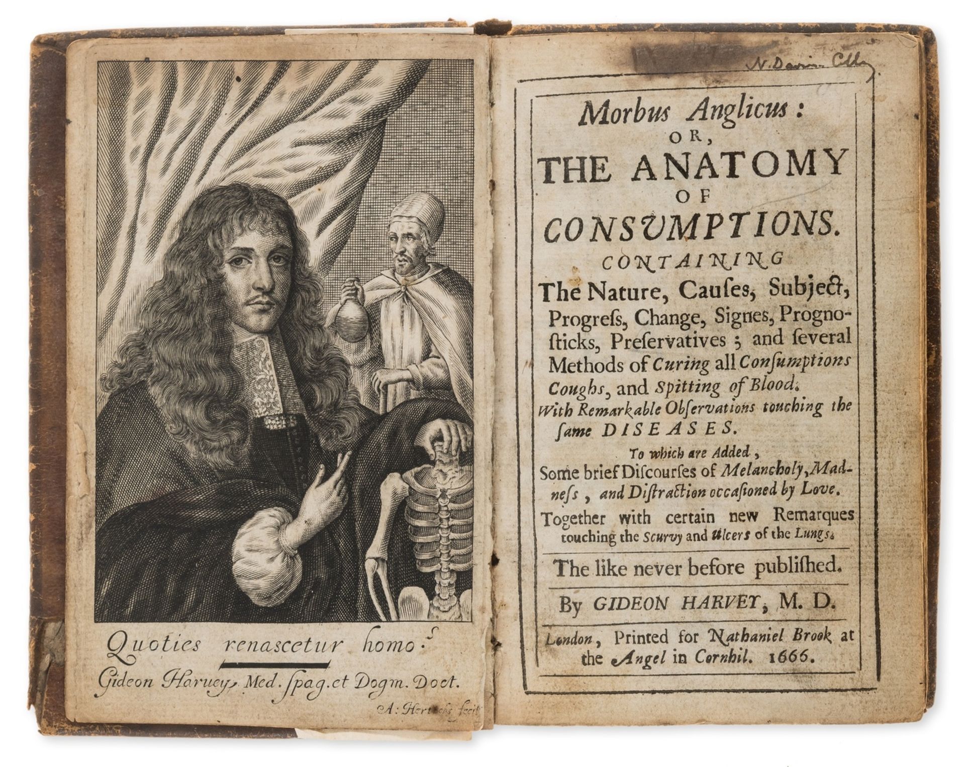 Tuberculosis.- Harvey (Gideon) Morbus Anglicus: or, The Anatomy of Consumptions, first edition, …