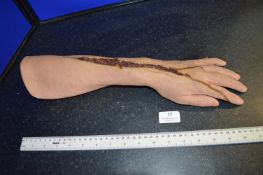 *Plaster Forearm with Injury Detail