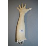 *Female Plaster Full Lower Arm Cast