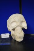 *Plaster Cast Skull