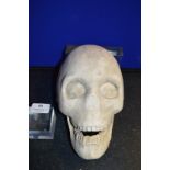 *Plaster Half Cast of a Skull and Jaw