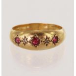 18ct yellow gold Edwardian diamond and synthetic ruby gypsy ring, hallmarked Birmingham 1907, finger