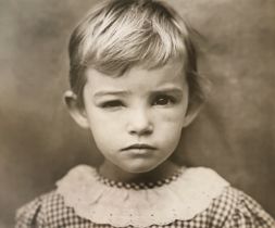 Sally Mann â€œDamaged Child, 1984â€ Print