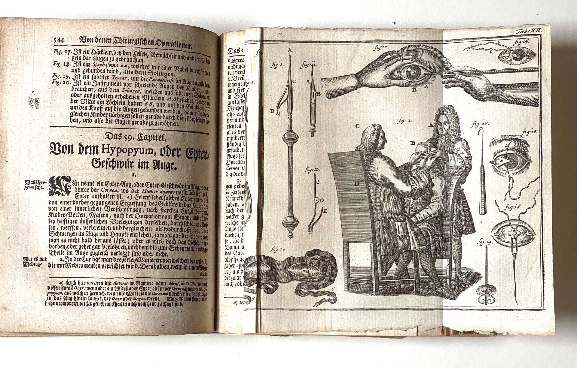 Laurentius (Lorenz) Heister,  Lehrbuch der Chirurgie, Nürnberg 1731