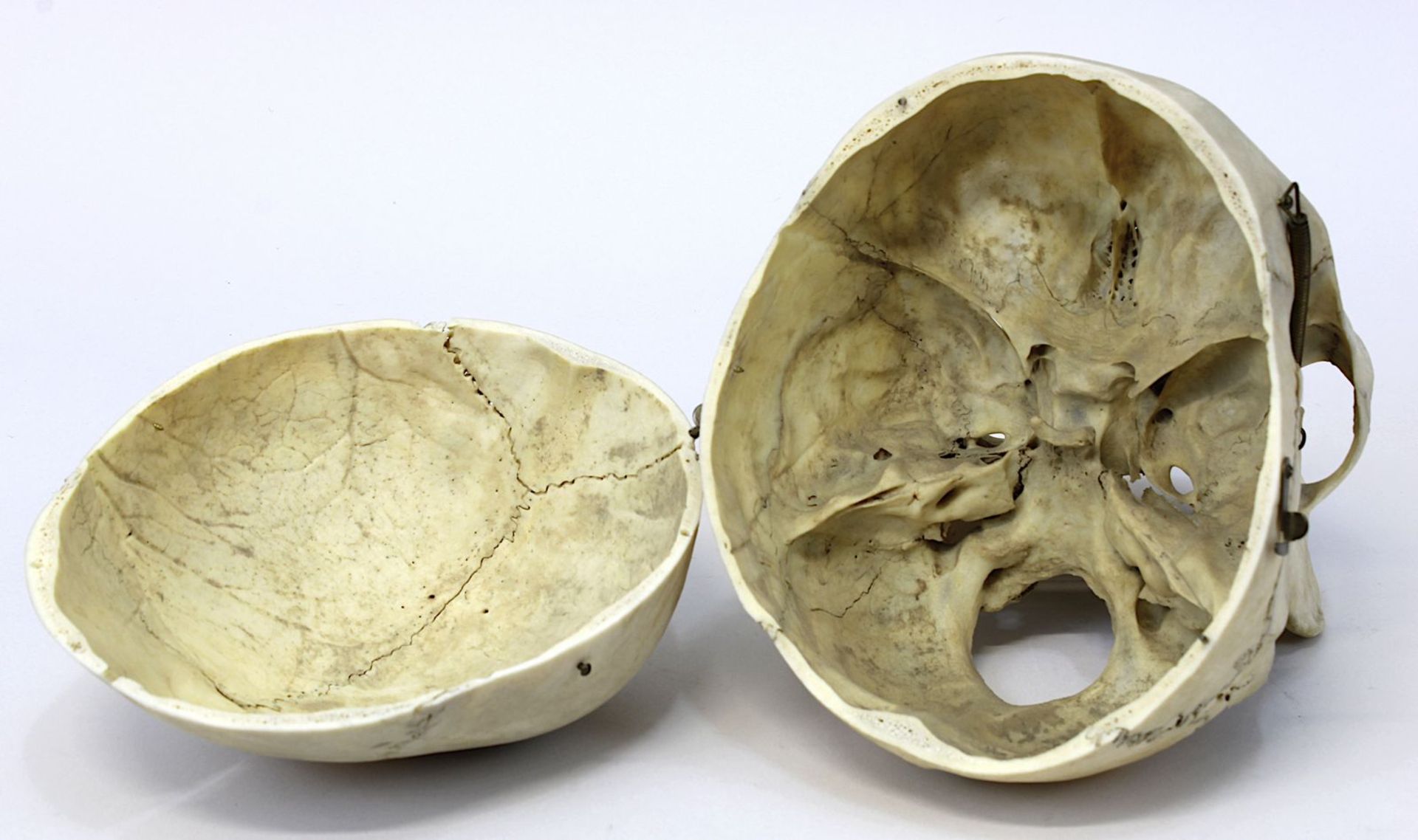 Menschlicher Schädel, anatomisches Präparat, echter Schädel eines Erwachsenen, Schädeldecke - Bild 2 aus 2