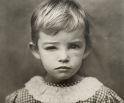 Sally Mann - Damaged Child, 1984