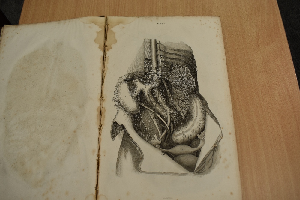 Antiquarian. Anatomy. Lizars, John - A System of Anatomical Plates of the Human Body, Accompanied - Image 8 of 20