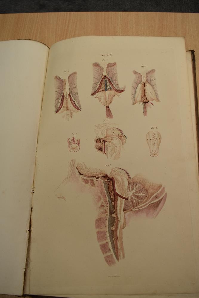 Antiquarian. Anatomy. Lizars, John - A System of Anatomical Plates of the Human Body, Accompanied - Image 15 of 20