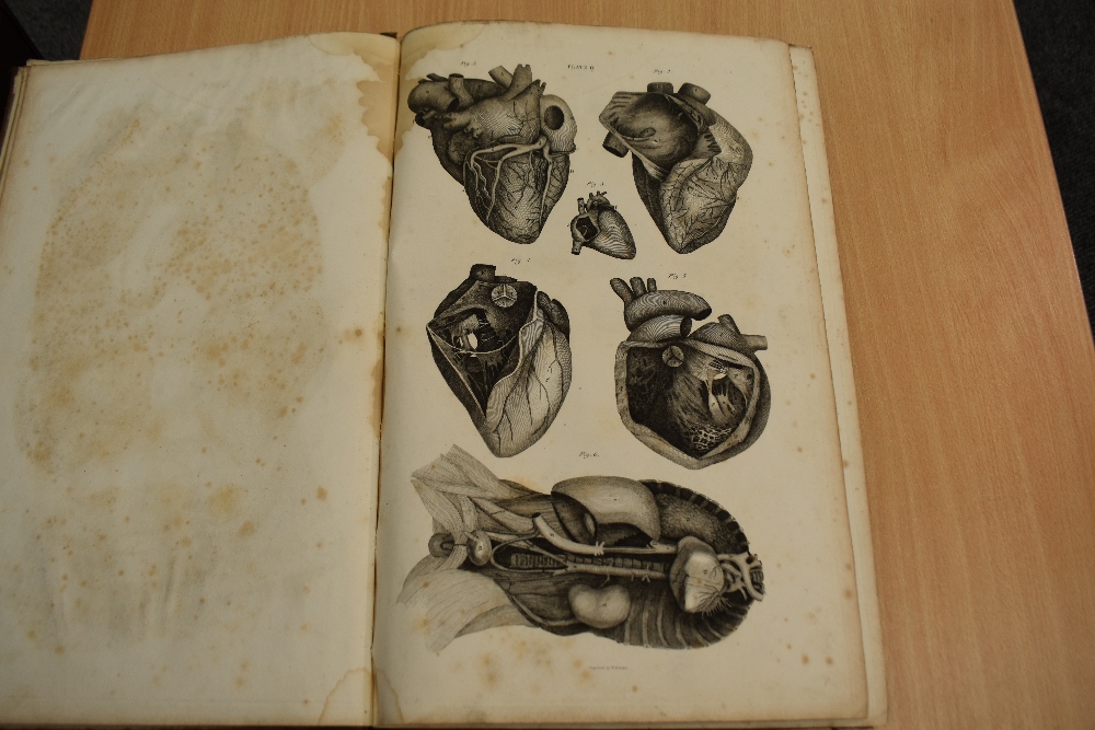 Antiquarian. Anatomy. Lizars, John - A System of Anatomical Plates of the Human Body, Accompanied - Image 7 of 20