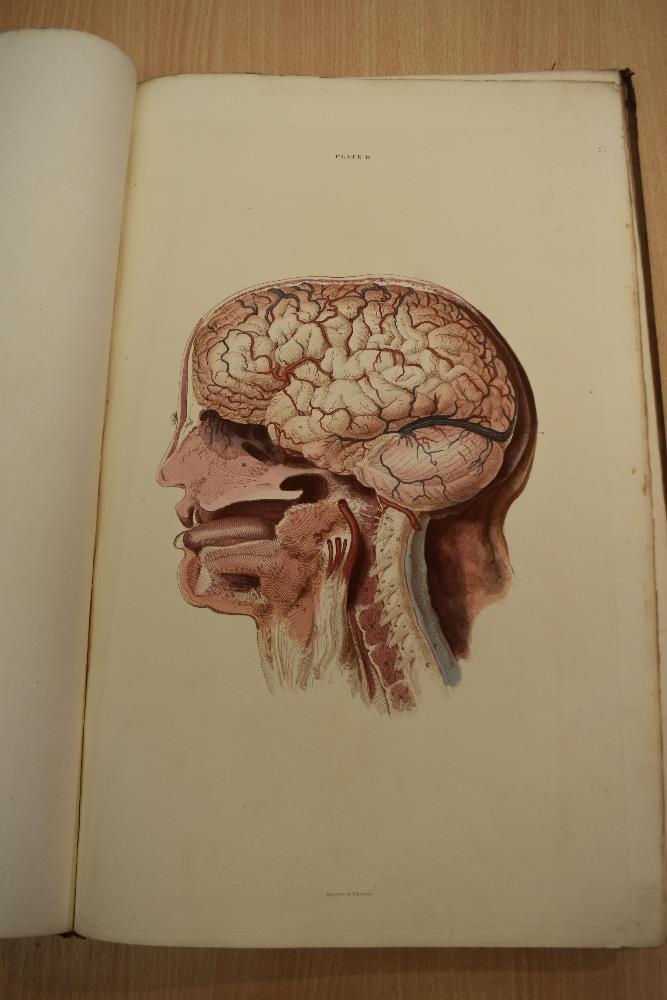 Antiquarian. Anatomy. Lizars, John - A System of Anatomical Plates of the Human Body, Accompanied - Image 14 of 20