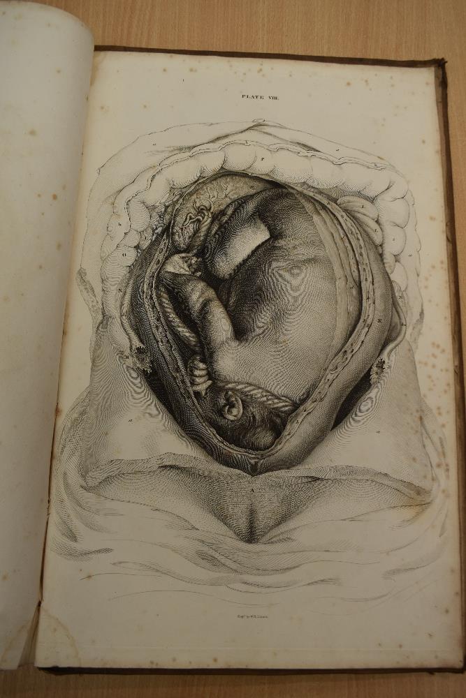 Antiquarian. Anatomy. Lizars, John - A System of Anatomical Plates of the Human Body, Accompanied - Image 18 of 20