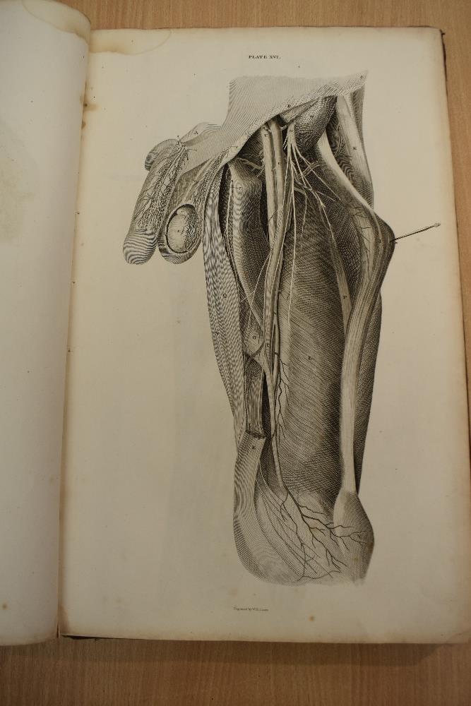 Antiquarian. Anatomy. Lizars, John - A System of Anatomical Plates of the Human Body, Accompanied - Image 10 of 20