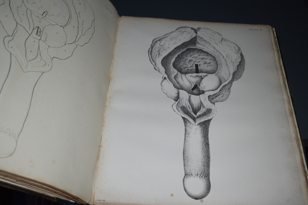 Antiquarian. Medical History. Crosse, John Green - A Treatise on the Formation, Constituents, and - Image 3 of 3